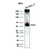 PRAME Antibody SK-MEL-2 WB. Western blot analysis of human SK-MEL-2 melanoma cell lysate using PRAME antibody clone PRAME/8558R. A distinct band is detected at approximately 58-60 kDa, consistent with the expected molecular weight of Preferentially expressed antigen in melanoma / PRAME, a cancer-testis antigen involved in transcriptional regulation and tumor-associated immune signaling pathways. The observed signal is consistent with established PRAME expression in melanoma-associated tumor cell models.