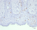 IHC staining of FFPE human skin tissue with Langerin antibody (clone LGRN/7430). HIER: boil tissue sections in pH 9 10mM Tris with 1mM EDTA for 20 min and allow to cool before testing.