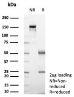 SDS-PAGE analysis of purified, BSA-free Langerin antibody (clone LGRN/7541) as confirmation of integrity and purity.