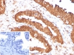 IHC staining of FFPE human prostate tissue with MIF antibody (clone MIF/6281). Inset: PBS used in place of primary Ab (secondary Ab negative control). HIER: boil tissue sections in pH 9 10mM Tris with 1mM EDTA for 20 min and allow to cool before testing.