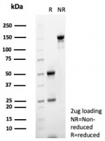 SDS-PAGE analysis of purified, BSA-free MIF antibody (clone MIF/6281) as confirmation of integrity and purity.