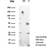 SDS-PAGE analysis of purified, BSA-free MIF antibody (clone MIF/6282) as confirmation of integrity and purity.