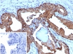 IHC staining of FFPE human prostate tissue with Macrophage migration inhibitory factor antibody (clone MIF/6283). Inset: PBS used in place of primary Ab (secondary Ab negative control). HIER: boil tissue sections in pH 9 10mM Tris with 1mM EDTA for 20 min and allow to cool before testing.