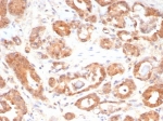 IHC staining of FFPE human prostate tissue with Macrophage migration inhibitory factor antibody (clone MIF/6283). HIER: boil tissue sections in pH 9 10mM Tris with 1mM EDTA for 20 min and allow to cool before testing.