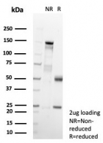 SDS-PAGE analysis of purified, BSA-free Glycosylation inhibiting factor antibody (clone MIF/6278) as confirmation of integrity and purity.