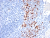 IHC staining of FFPE human tonsil tissue with SCD1 antibody (clone SDC1/7183). HIER: boil tissue sections in pH 9 10mM Tris with 1mM EDTA for 20 min and allow to cool before testing.