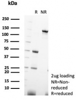 SDS-PAGE analysis of purified, BSA-free PVALB antibody (clone PVALB/7601) as confirmation of integrity and purity.