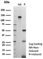 SDS-PAGE analysis of purified, BSA-free FABP3 antibody (clone FABP3/8442) as confirmation of integrity and purity.