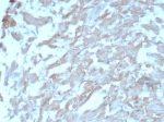 IHC staining of FFPE human heart tissue with FABP3 antibody (clone FABP3/8442). HIER: boil tissue sections in pH 9 10mM Tris with 1mM EDTA for 20 min and allow to cool before testing.
