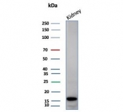 Western blot testing of human kidney tissue lysate with FABP1 antibody (clone FABP1/4517). Predicted molecular weight ~14 kDa.