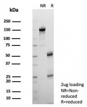 SDS-PAGE analysis of purified, BSA-free FABP1 antibody (clone FABP1/4517) as confirmation of integrity and purity.