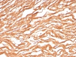 IHC staining of FFPE human heart tissue with FABP3 antibody (clone FABP3/8443). HIER: boil tissue sections in pH 9 10mM Tris with 1mM EDTA for 20 min and allow to cool before testing.