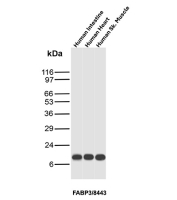FABP3 Antibody Tissue WB. Western blot analysis of human intestine, human heart, and human skeletal muscle tissue lysates using FABP3 antibody clone FABP3/8443. A prominent band is detected at approximately 15 kDa in all tested samples, consistent with the predicted molecular weight of Fatty acid-binding protein 3 / FABP3. The strong signal observed in heart and skeletal muscle lysates aligns with the established role of FABP3 in intracellular fatty acid transport and energy metabolism within highly oxidative muscle tissues.