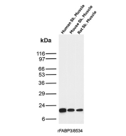 FABP3 Antibody Skeletal Muscle WB. Western blot analysis of human skeletal muscle, mouse skeletal muscle, and rat skeletal muscle tissue lysates using FABP3 antibody clone rFABP3/8534. A clear band is detected at approximately 15 kDa across all skeletal muscle samples, consistent with the predicted molecular weight of Fatty acid-binding protein 3 / FABP3. The conserved expression pattern among multiple mammalian species is consistent with the known role of FABP3 in fatty acid transport and oxidative energy metabolism within striated muscle tissue.