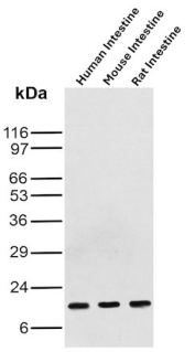 FABP3 Antibody Intestine WB. Western blot analysis of human intestine, mouse intestine, and rat intestine tissue lysates using FABP3 antibody clone rFABP3/8534. A distinct band is detected at approximately 15 kDa in all intestinal samples, consistent with the predicted molecular weight of Fatty acid-binding protein 3 / FABP3. The observed intestinal expression pattern supports the known role of FABP3 in intracellular fatty acid trafficking and lipid metabolism within metabolically active epithelial tissues.