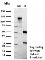 SDS-PAGE analysis of purified, BSA-free recombinant FABP1 antibody (clone rFABP1/8520) as confirmation of integrity and purity.