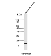 Cardiac Fatty Acid Binding Protein Antibody Skeletal Muscle WB. Western blot analysis of human skeletal muscle tissue lysate using Cardiac fatty acid binding protein antibody clone FABP3/8535R. A distinct band is detected at approximately 15 kDa, consistent with the predicted molecular weight of Fatty acid-binding protein 3 / FABP3. The observed skeletal muscle expression aligns with the established role of FABP3 in intracellular fatty acid transport and oxidative energy metabolism within striated muscle tissue.