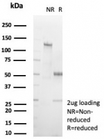 SDS-PAGE analysis of purified, BSA-free Cardiac Fatty Acid Binding Protein antibody (clone FABP3/8535R) as confirmation of integrity and purity.