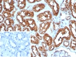IHC staining of FFPE human heart tissue with Cardiac Fatty Acid Binding Protein antibody (clone FABP3/8535R). HIER: boil tissue sections in pH 9 10mM Tris with 1mM EDTA for 20 min and allow to cool before testing.