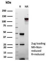 SDS-PAGE analysis of purified, BSA-free Fatty Acid Binding Protein 1 antibody (clone FABP1/8521R) as confirmation of integrity and purity.