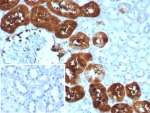 IHC staining of FFPE human kidney tissue with Fatty Acid Binding Protein 1 antibody (clone FABP1/8521R). Inset: PBS used in place of primary Ab (secondary Ab negative control). HIER: boil tissue sections in pH 9 10mM Tris with 1mM EDTA for 20 min and allow to cool before testing.