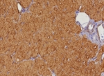 IHC staining of FFPE human heart tissue with Heart Fatty Acid Binding Protein antibody (clone FABP3/8343R). HIER: boil tissue sections in pH 9 10mM Tris with 1mM EDTA for 20 min and allow to cool before testing.