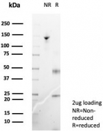 SDS-PAGE analysis of purified, BSA-free Langerin antibody (clone LGRN/7357) as confirmation of integrity and purity.