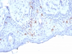 IHC staining of FFPE human skin tissue with Langerin antibody (clone LGRN/7357). HIER: boil tissue sections in pH 9 10mM Tris with 1mM EDTA for 20 min and allow to cool before testing.