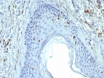 IHC staining of FFPE human skin tissue with Langerin antibody (clone LGRN/7428). HIER: boil tissue sections in pH 9 10mM Tris with 1mM EDTA for 20 min and allow to cool before testing.