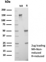 SDS-PAGE analysis of purified, BSA-free Choriogonadotropin Receptor antibody (clone LHCGR/7398) as confirmation of integrity and purity.