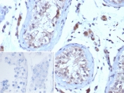 IHC staining of FFPE human testis tissue with Choriogonadotropin Receptor antibody (clone LHCGR/7398). Inset: PBS used in place of primary Ab (secondary Ab negative control). HIER: boil tissue sections in pH 9 10mM Tris with 1mM EDTA for 20 min and allow to cool before testing.