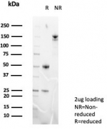 SDS-PAGE analysis of purified, BSA-free Luteinizing Hormone Receptor antibody (clone LHCGR/7399) as confirmation of integrity and purity.