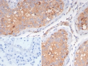 IHC staining of FFPE human testis tissue with Luteinizing Hormone Receptor antibody (clone LHCGR/7399). Inset: PBS used in place of primary Ab (secondary Ab negative control). HIER: boil tissue sections in pH 9 10mM Tris with 1mM EDTA for 20 min and allow to cool before testing.