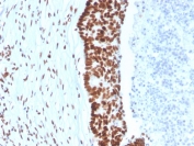 IHC staining of FFPE human colon tissue with MutS homolog 2 antibody (clone MSH2/3165). HIER: boil tissue sections in pH 9 10mM Tris with 1mM EDTA for 20 min and allow to cool before testing.