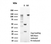 SDS-PAGE analysis of purified, BSA-free MutS homolog 2 antibody (clone MSH2/3165) as confirmation of integrity and purity.