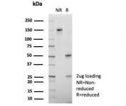 SDS-PAGE analysis of purified, BSA-free CEBPZ antibody (clone PCRP-CEBPZ-2D8) as confirmation of integrity and purity.