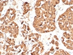 IHC staining of FFPE human pituitary gland tissue with ACTH antibody (clone CLIP/7197R). HIER: boil tissue sections in pH 9 10mM Tris with 1mM EDTA for 20 min and allow to cool before testing.