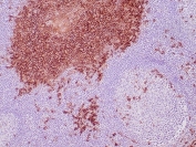 IHC staining of FFPE human tonsil tissue with CD138 antibody (clone SDC1/7177). HIER: boil tissue sections in pH 9 10mM Tris with 1mM EDTA for 20 min and allow to cool before testing.