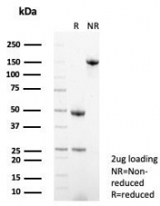 SDS-PAGE analysis of purified, BSA-free Syndecan-1 antibody (clone SDC1/7178) as confirmation of integrity and purity.