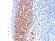 IHC staining of FFPE human tonsil tissue with Syndecan-1 antibody (clone SDC1/7178). HIER: boil tissue sections in pH 9 10mM Tris with 1mM EDTA for 20 min and allow to cool before testing.