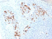 IHC staining of FFPE human tonsil tissue with Syndecan-1 antibody (clone SDC1/7182). HIER: boil tissue sections in pH 9 10mM Tris with 1mM EDTA for 20 min and allow to cool before testing.