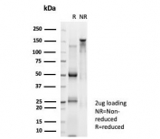 SDS-PAGE analysis of purified, BSA-free MYCN antibody (clone PCRP-MYCN-1A9) as confirmation of integrity and purity.