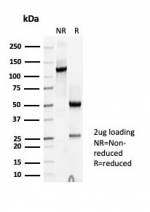 SDS-PAGE analysis of purified, BSA-free Thyroid Peroxidase antibody (clone TPO/7088R) as confirmation of integrity and purity.