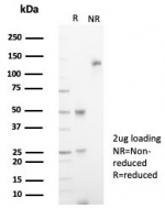 SDS-PAGE analysis of purified, BSA-free Interleukin 18 receptor alpha antibody (clone IL18R1/7592) as confirmation of integrity and purity.