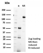 SDS-PAGE analysis of purified, BSA-free IL-18R alpha antibody (clone IL18R1/7593) as confirmation of integrity and purity.