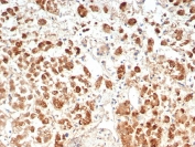 IHC staining of FFPE human adrenal gland tissue with IL-18R alpha antibody (clone IL18R1/7593). HIER: boil tissue sections in pH 9 10mM Tris with 1mM EDTA for 20 min and allow to cool before testing.