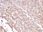 IHC staining of FFPE human adrenal gland tissue with IL-1RA antibody (clone IL1RA/4712). HIER: boil tissue sections in pH 9 10mM Tris with 1mM EDTA for 20 min and allow to cool before testing.