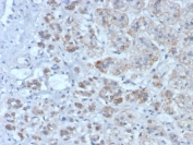 IHC staining of FFPE human adrenal gland tissue with Interleukin-1 Receptor Antagonist antibody (clone IL1RA/4715). HIER: boil tissue sections in pH 9 10mM Tris with 1mM EDTA for 20 min and allow to cool before testing.