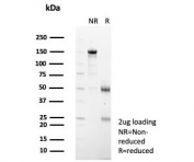 SDS-PAGE analysis of purified, BSA-free Interleukin-1 Receptor Antagonist antibody (clone IL1RA/4715) as confirmation of integrity and purity.