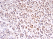 IHC staining of FFPE human adrenal gland tissue with IL1RN antibody (clone IL1RA/4716). HIER: boil tissue sections in pH 9 10mM Tris with 1mM EDTA for 20 min and allow to cool before testing.